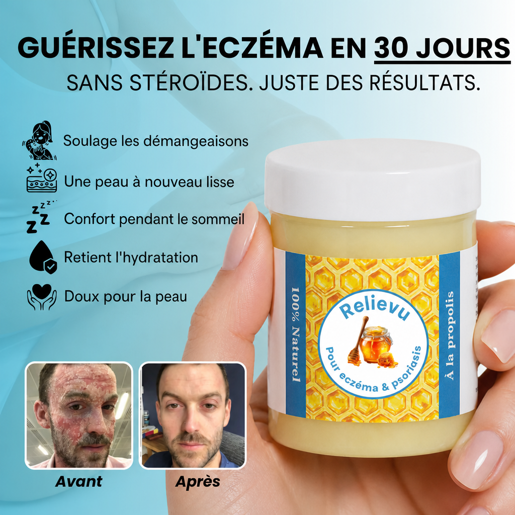 Apaise l'eczéma — sans stéroïdes