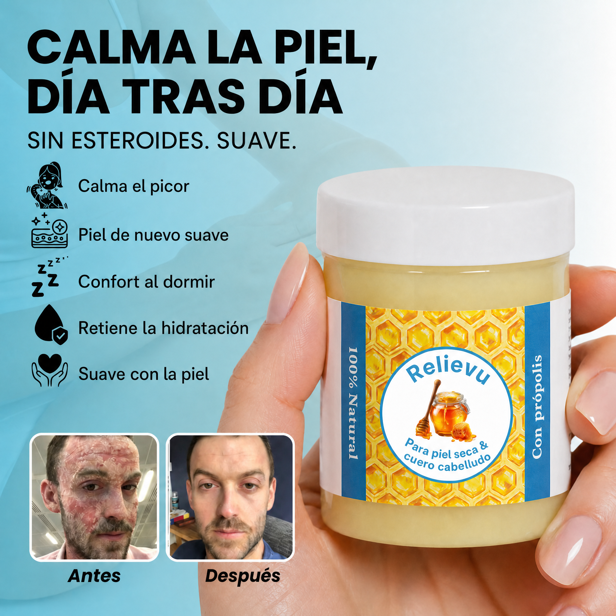 Calma la piel, día tras día. Sin esteroides.